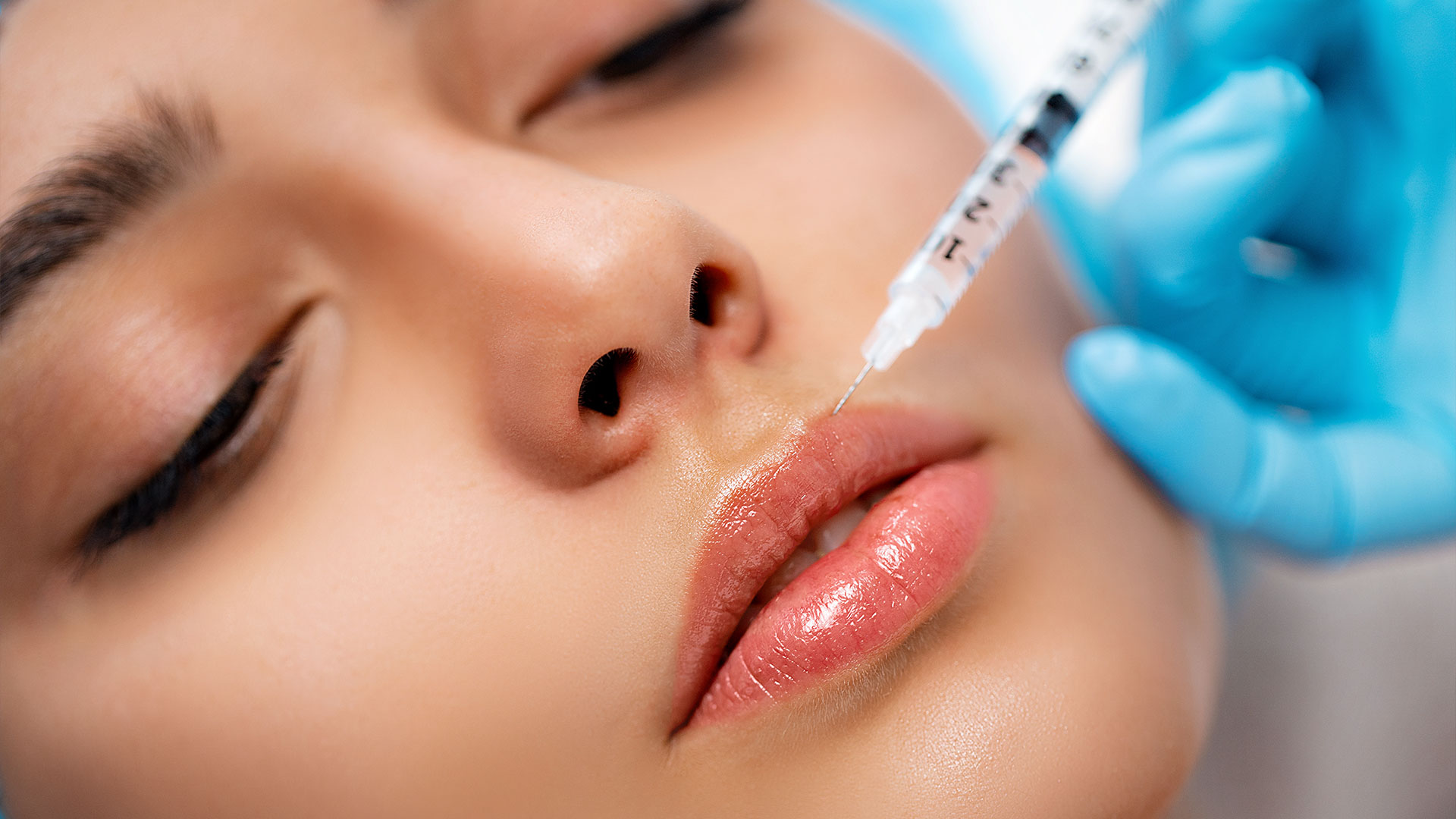 Dermal Filler