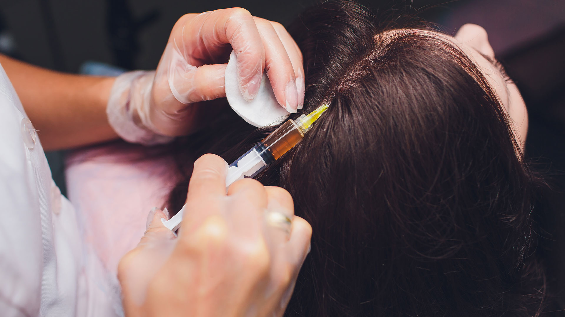 PRP and Mesotherapy